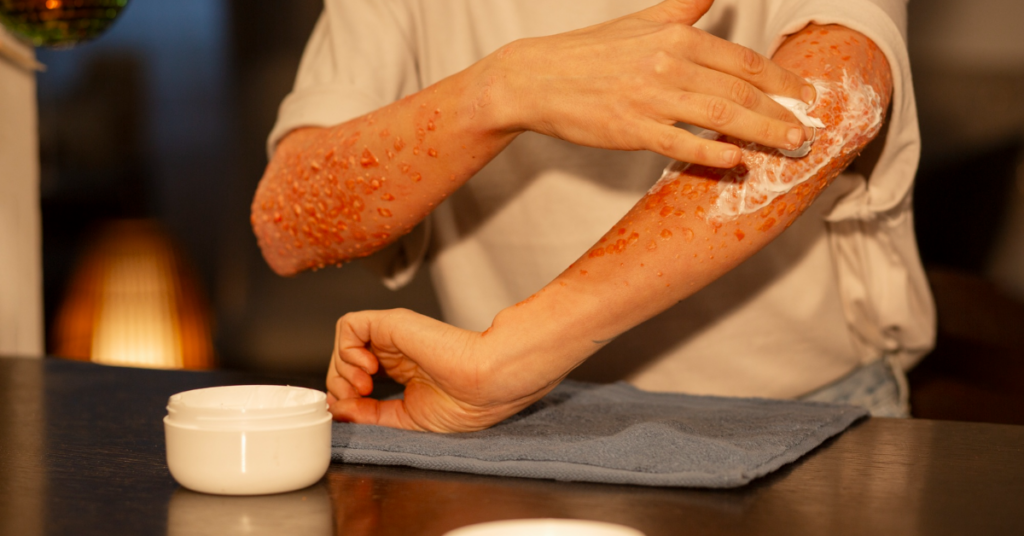 skin & soft tissue infection treatment in indore
