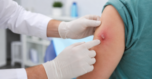 infections treatment in indore